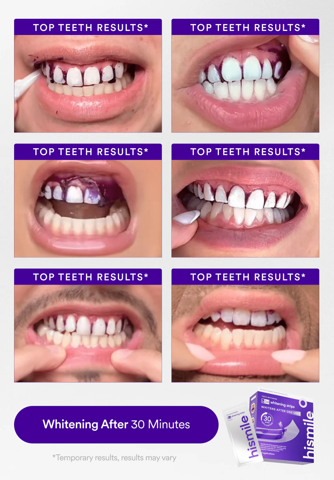 Affordable Whitening Set - Image 3