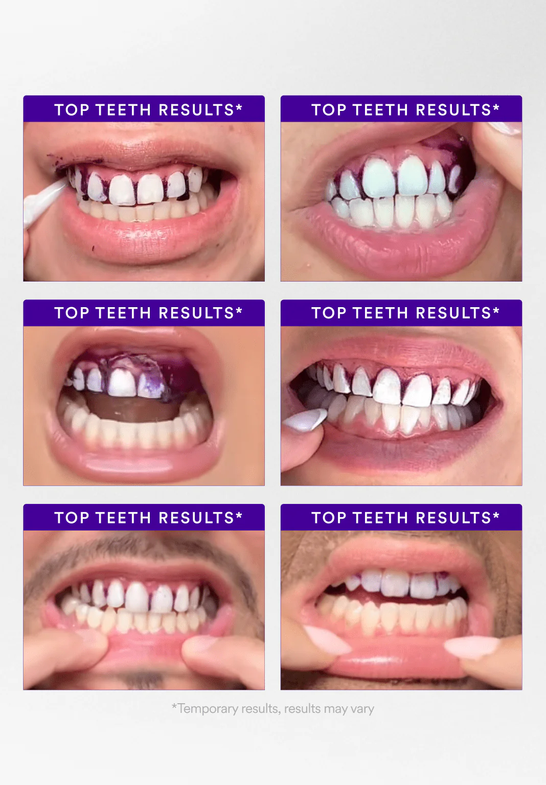 Buy 2 Get 1 Free - V34 Whitening Strips - Image 4