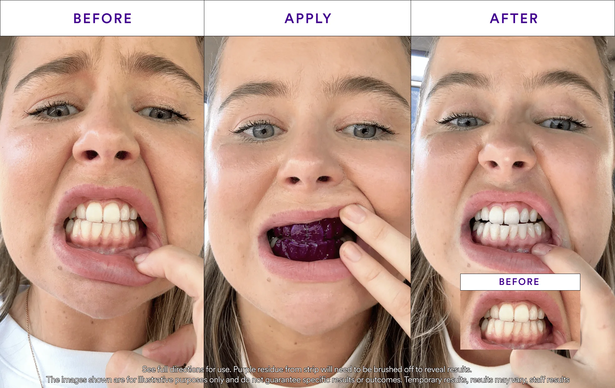Buy 2 Get 1 Free - V34 Whitening Strips - Image 6